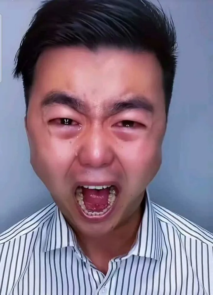 Meme Tức Giận